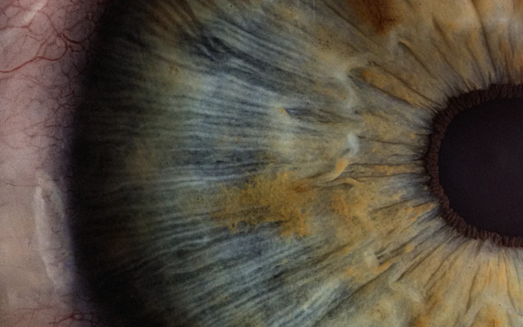 Understanding and Treating Infected Corneas (Keratitis) with Nanodropper